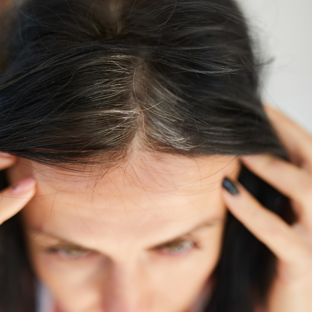 Como Cuidar do Cabelo e Couro Cabeludo no Inverno